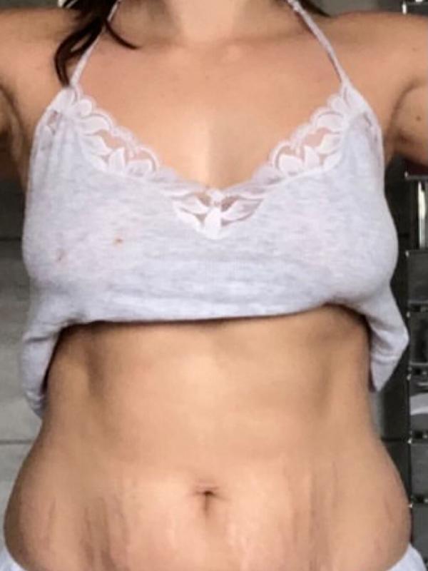 Lauren before transformation with Sean Dwyer Coaching